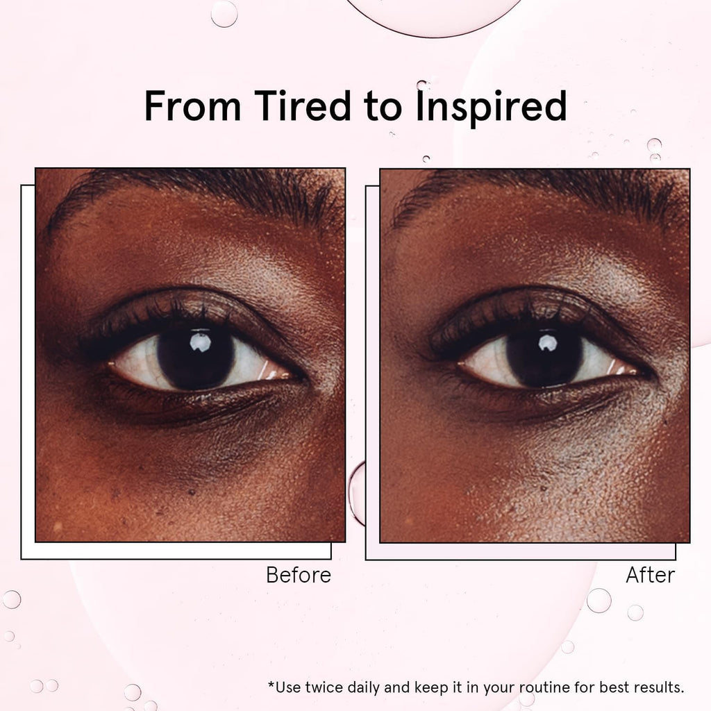 grace & stella Under Eye Brightener Roller - Airplane Travel Essentials - Travel Size Toiletries - Retinol & Caffeine Eye Serum for Puffiness, Dark Circles, Wrinkles - Vegan Skincare (15ml / 0.51floz)