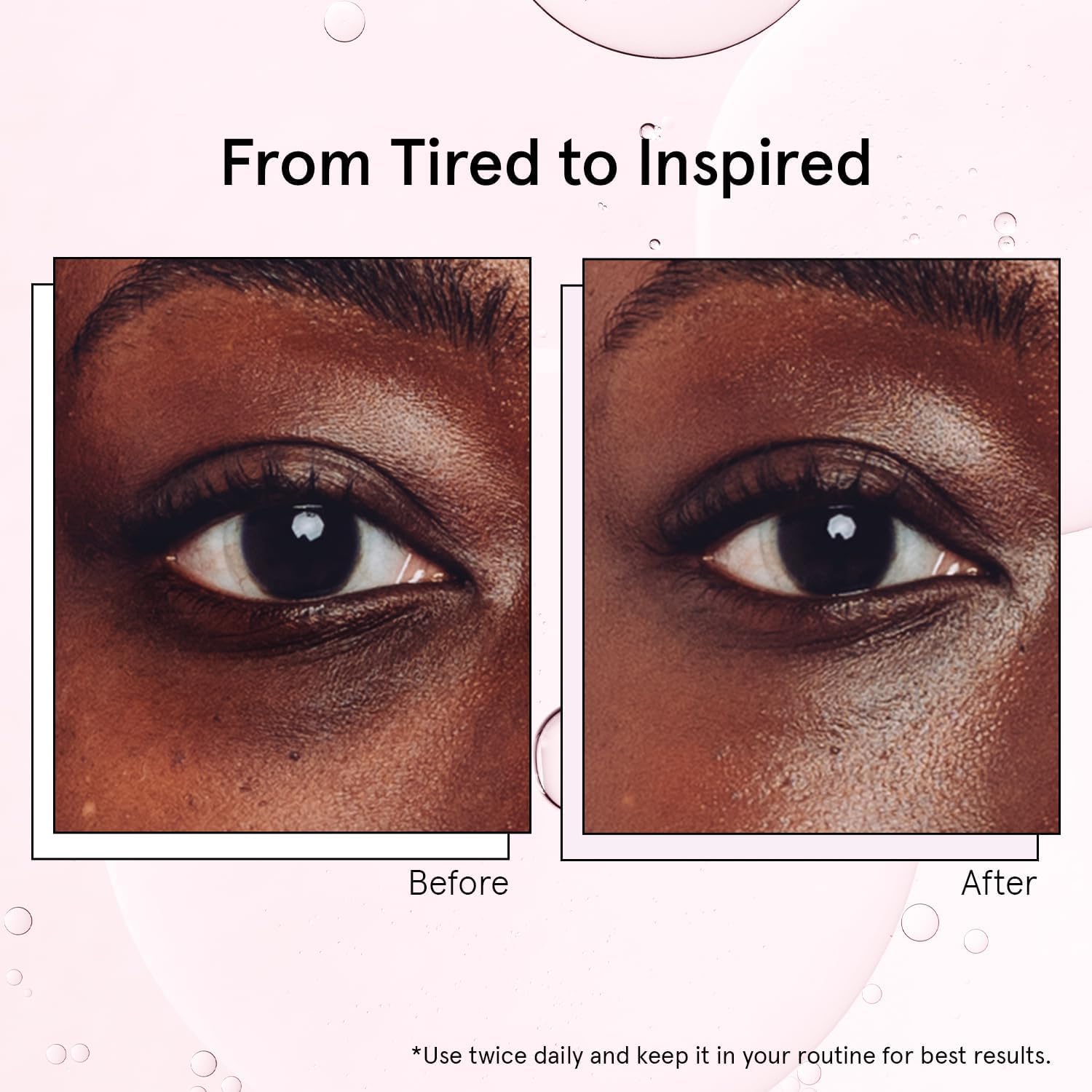grace & stella Under Eye Brightener Roller - Airplane Travel Essentials - Travel Size Toiletries - Retinol & Caffeine Eye Serum for Puffiness, Dark Circles, Wrinkles - Vegan Skincare (15ml / 0.51floz)