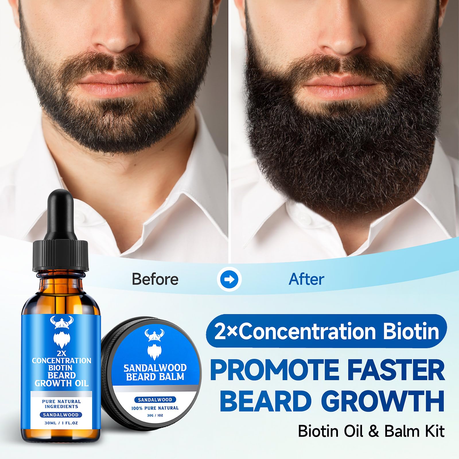 MistySprite Beard Growth Kit for Men, 2X Concentration Biotin Beard Oil & Styling Balm, Natural Facial Hair Conditioner with Argan, Jojoba & Vitamin E, Sandalwood Scent Softener